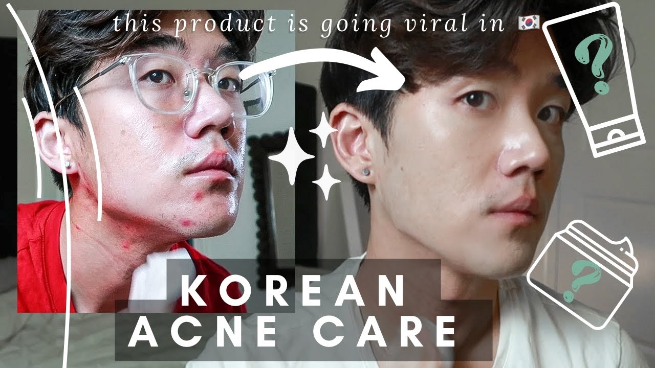 I Tried this Viral Korean Skincare that fixes textured skin &milia  ft Parnell