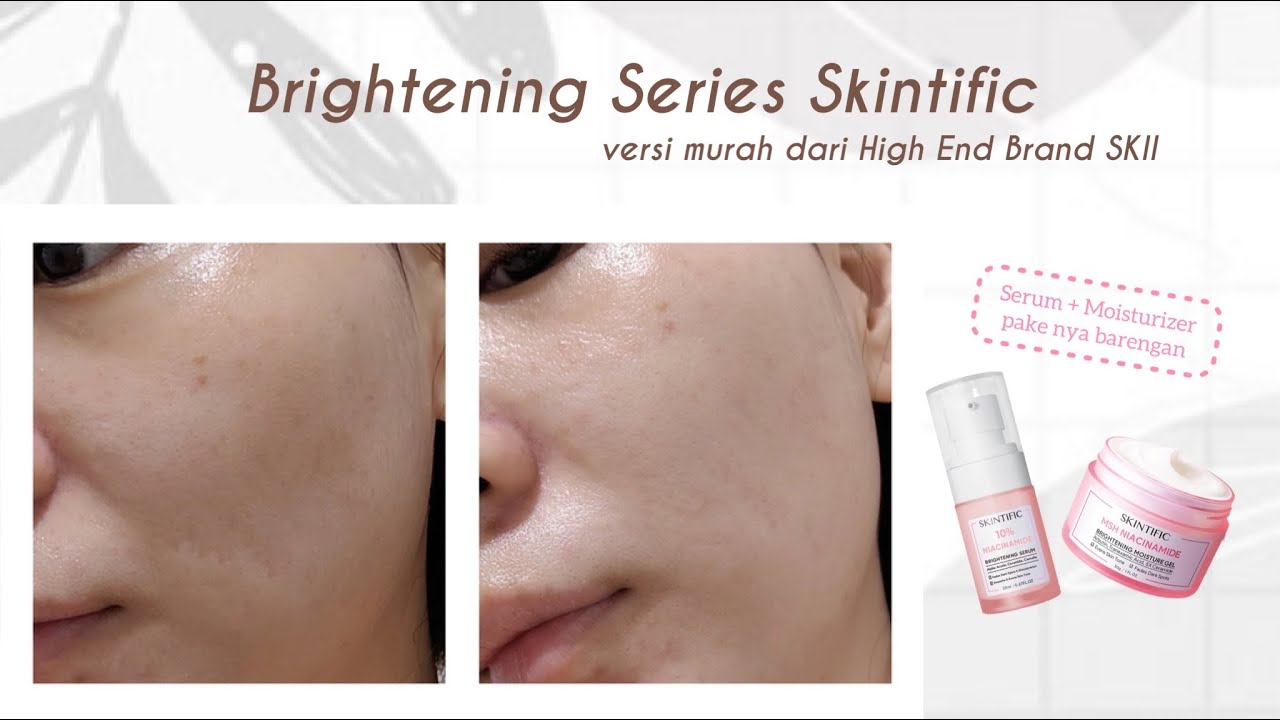 Akhirnya Nyobain 10% Niacinamice Serum + MSH Niacinamide Moisture Gel Skintific | Luella Artistry