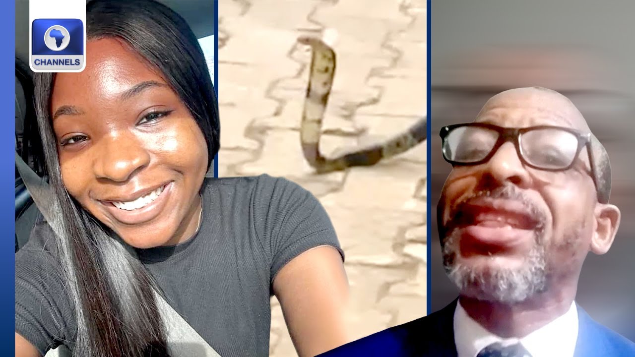 Ifunanya: Why Snake Bites Should Be Attended To Early -- Dr. Saheed Kehinde