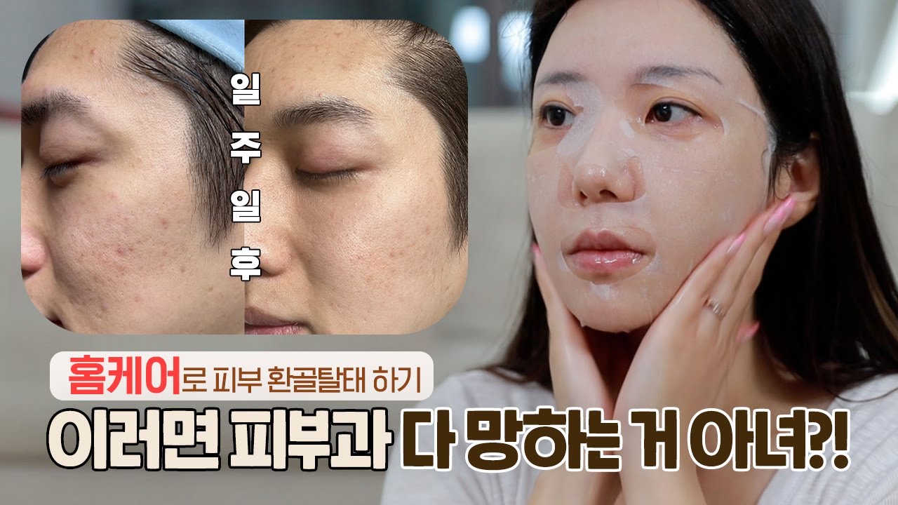 홈케어로 이게 가능해?! ㄹㅇ 피부 좋아지는 방법👍🏻 꼭 봐요!! (sMTS 마켓 23년 9/7일 4차 확정! 더보기란 꼭봐주세요! )/ 깡나