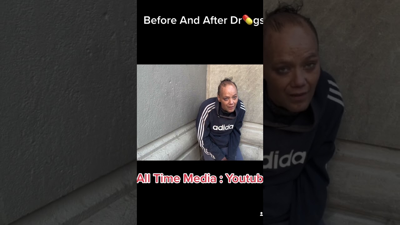 Before And After Addiction 🥺😞 #kensington #addiction #addict