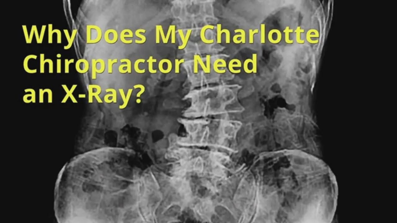 Why Does The Best Charlotte Chiropractor Near Me Need X rays?