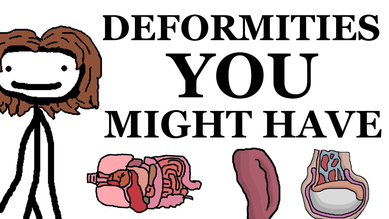 Deformities That You Might Have