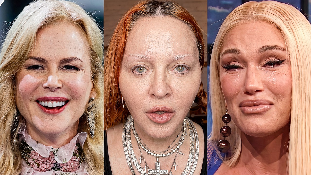 40+ Celebs Suffering From Pillow Face | Then and Now Photos 2026