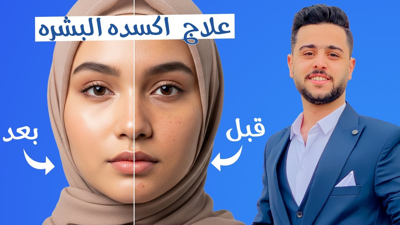 روشتة مجربة لحل مشكله البشرة اللي بتأكسد وتسمر فجأة #أكسدة_البشرة #نضاره_البشره