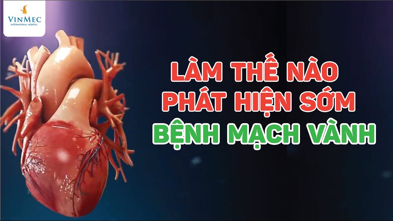 Ph&aacute;t hiện sớm bệnh mạch v&agrave;nh bằng c&aacute;ch n&agrave;o?