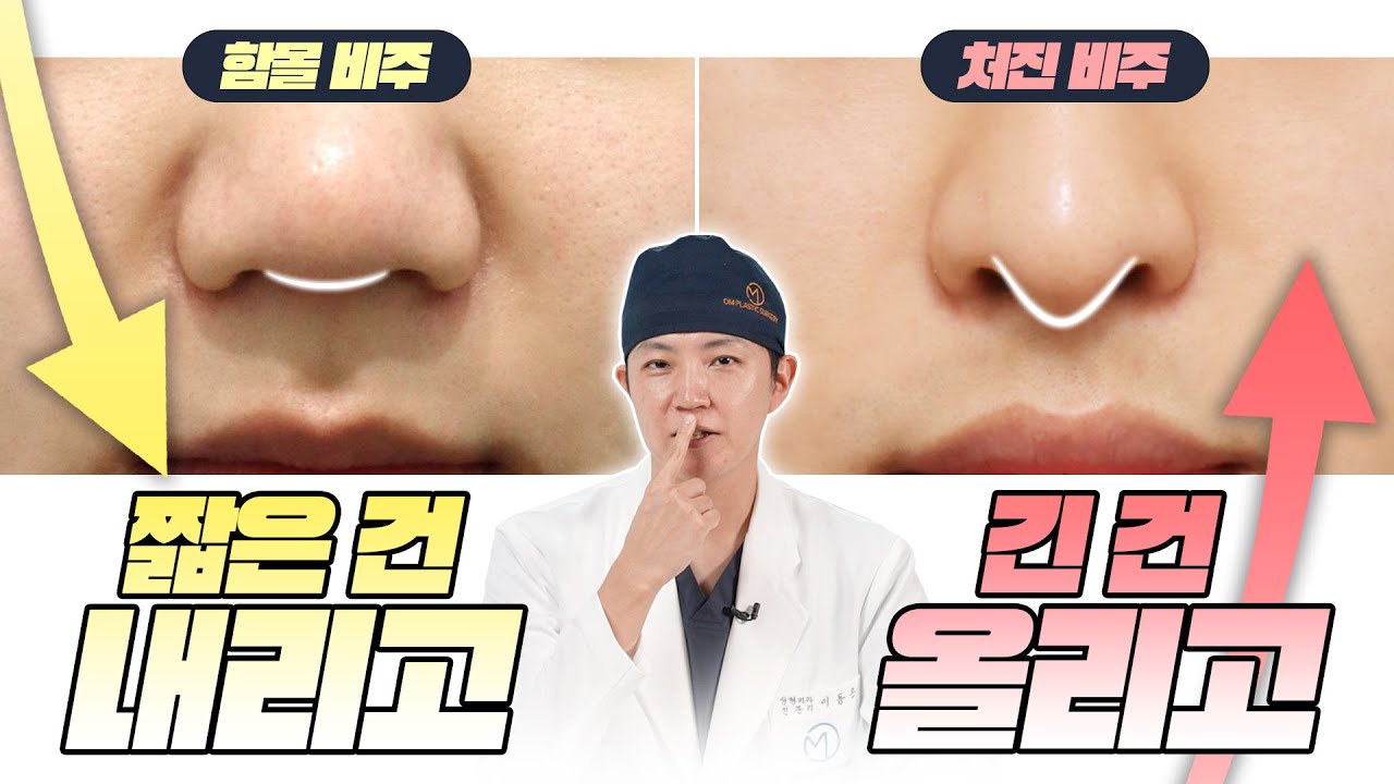 비주를 올리거나&uarr; 내리거나&darr; 코성형 할 때 비주가 중요한 이유! 비주가 예쁜 코는?!
