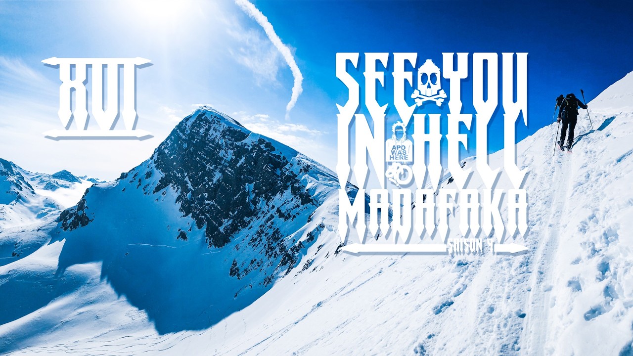 See You S9E16 bec de lievre
