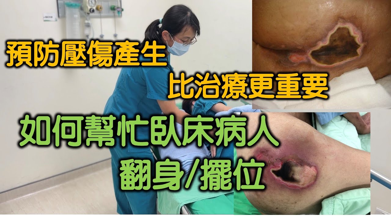 預防壓傷比治療更重要｜如何正確的幫病人翻身，擺位