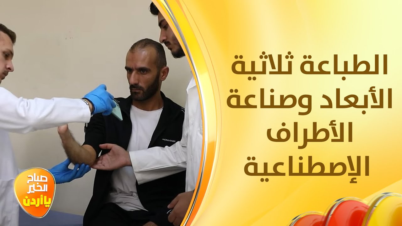 تكنولوجيا طباعة 3D تخفض كلف صناعة الأطراف الصناعية - صباح الخير يا اردن