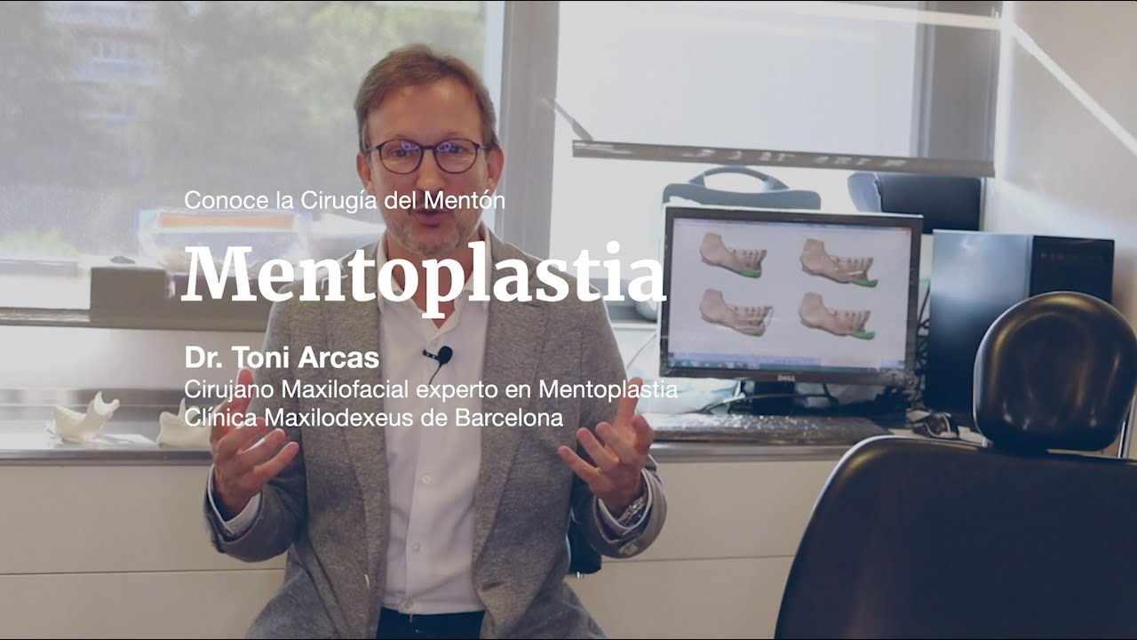 Mentoplastia o cirugía del mentón, todo lo que necesitas saber