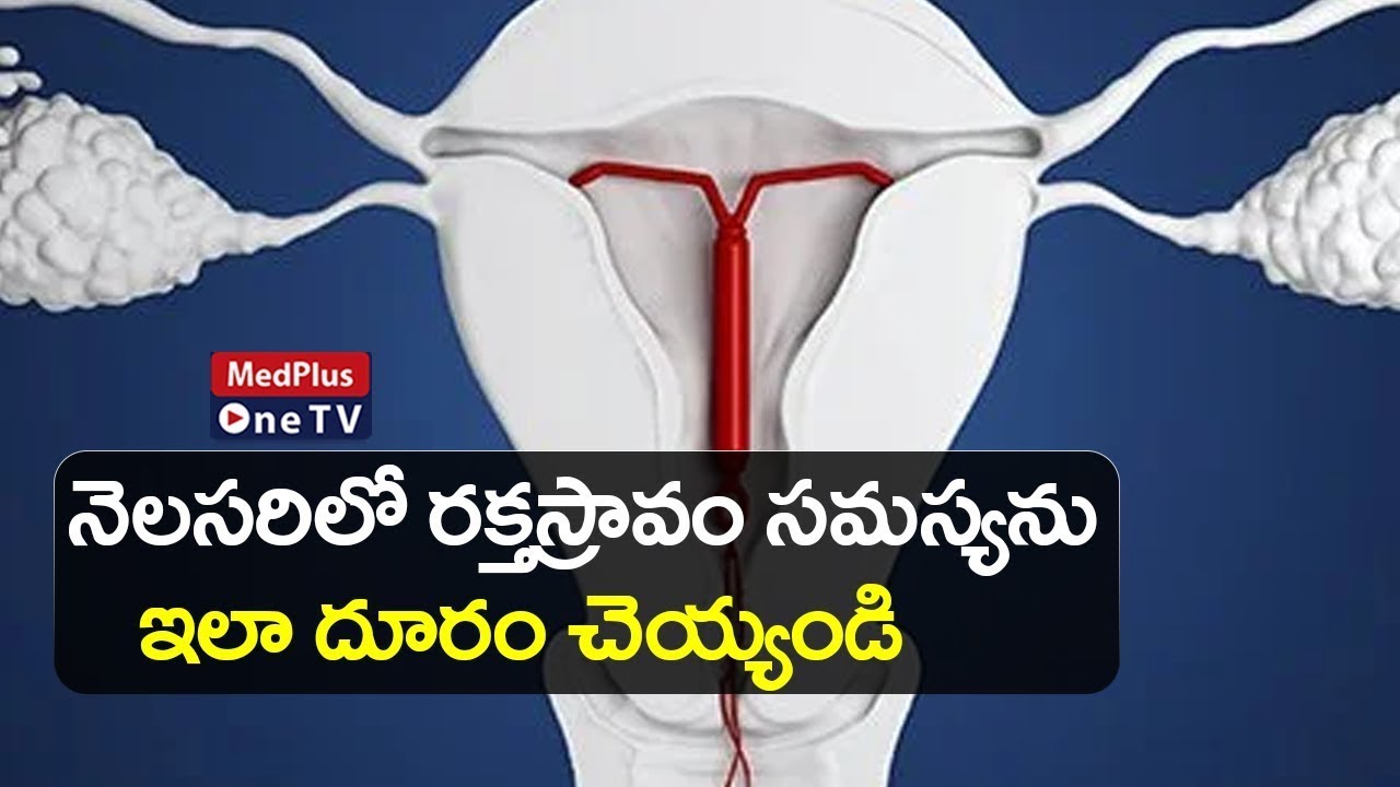 Mirena Uses and its Unknown Facts l Is it Safe to Use @MedPlusONETV