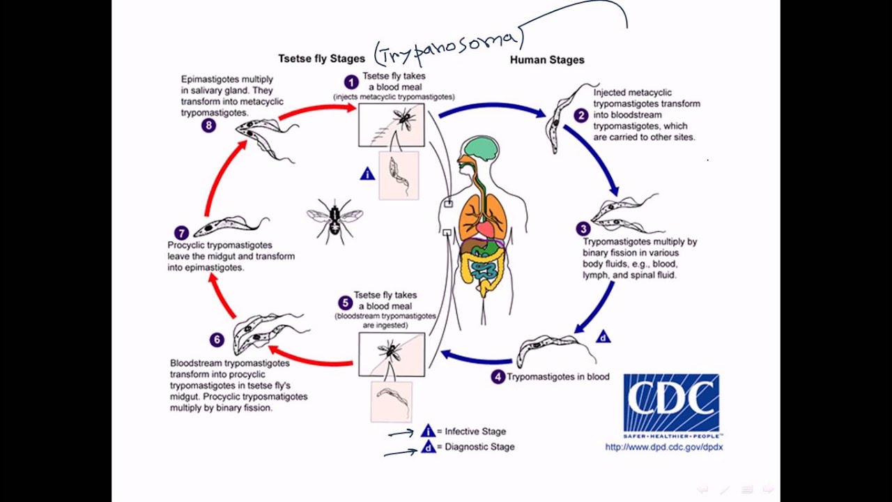 Sleeping sickness by trypanosoma