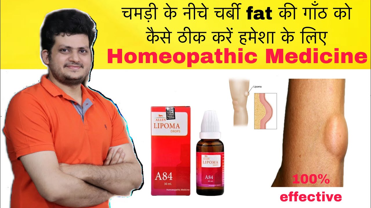 Lipoma Cure With ALLEN A84 Homeopathic Drop ? How to Use for 100 % Results |