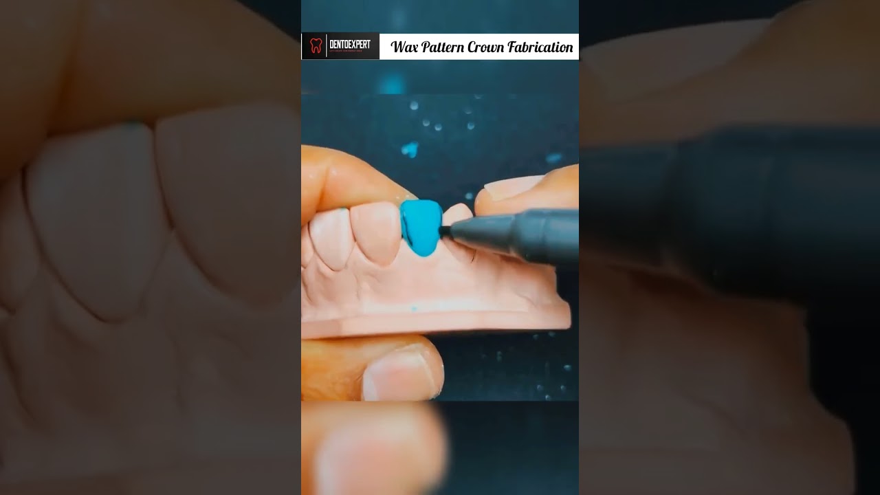 Wax Pattern for Crown Fabrication | Prefabrication of Wax Crown #shorts #dentist #ram #viral