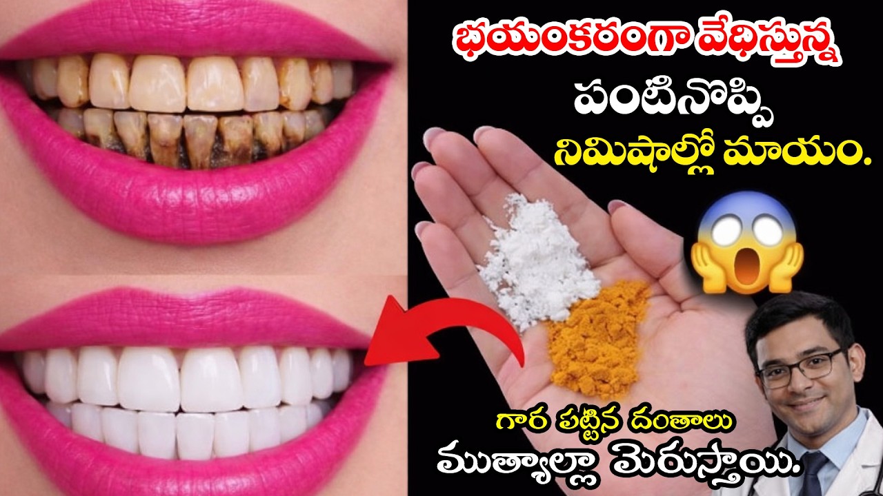 Dentist అవసరం లేకుండా పంటి నొప్పి పోతుంది! 🦷 Yellow Teeth నుంచి Snow White Smile 😁 Natural Remedy