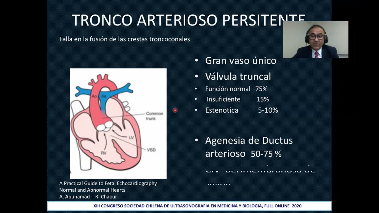 TRONCO ARTERIOSO  DR.MONTAÑO