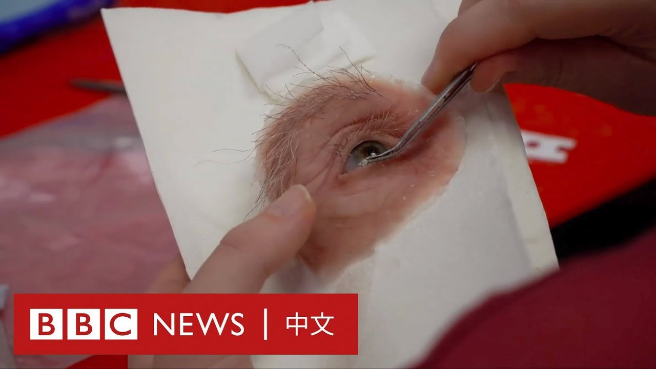 超現實的面部假體如何改變患者的生活？－ BBC News 中文