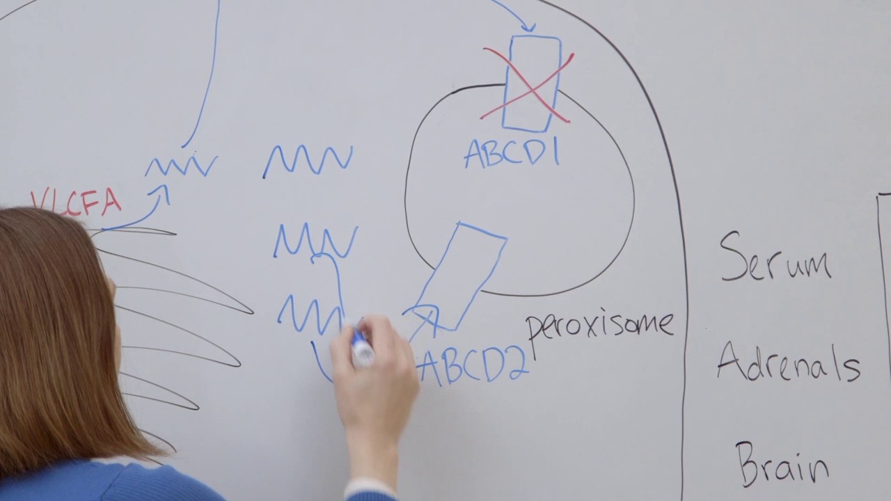 Thyroid hormone based strategy for correcting abnormality in X-ALD