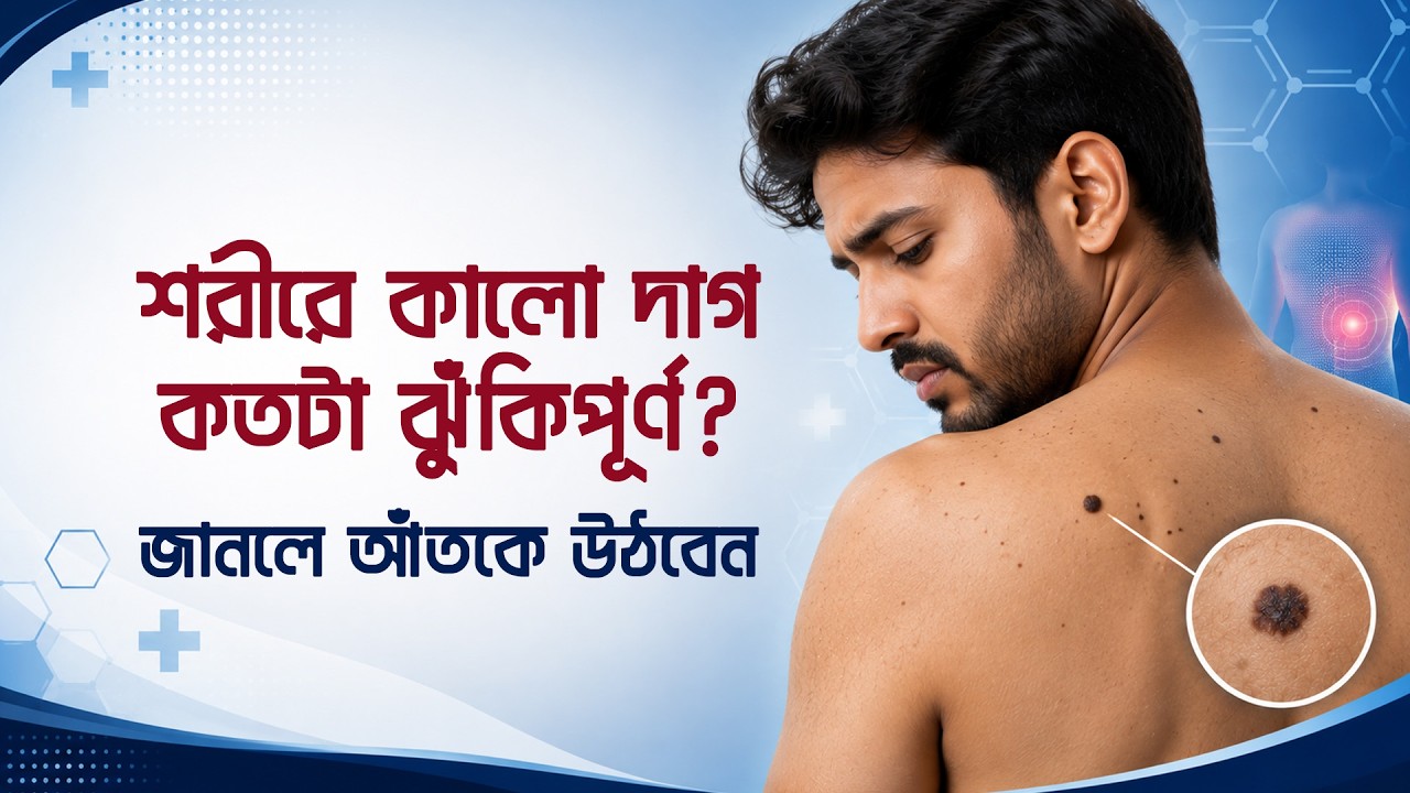 শরীরে কালো দাগ কতটা ঝুঁকিপূর্ণ | জানলে আঁতকে উঠবেন । সুস্থ থাকার উপায় | Bangla Health Tips