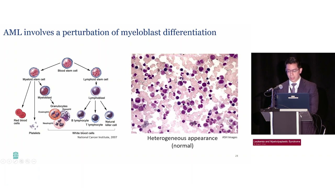 42 Лейкемия и миелодиспластический синдром HarvardUpdate Medstudylab.com