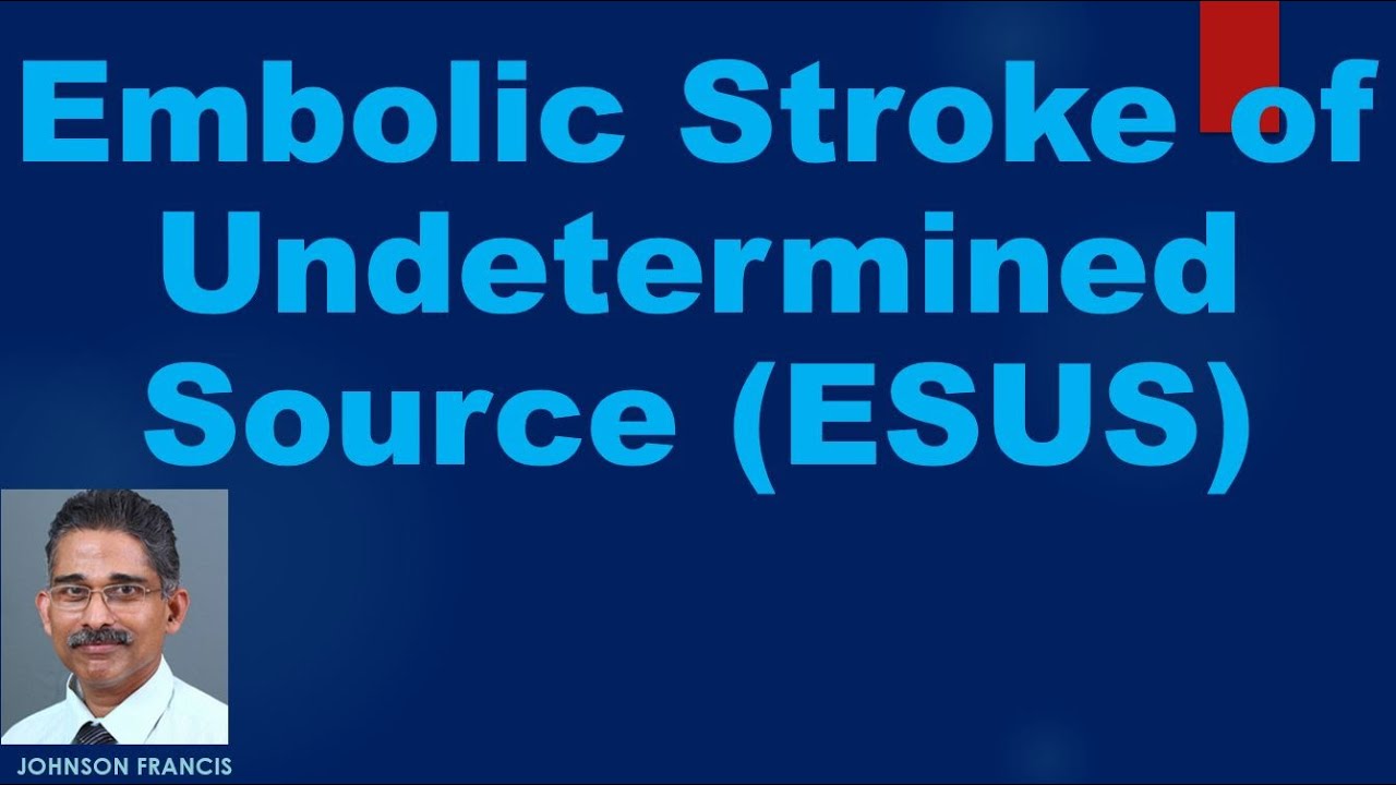 Embolic Stroke of Undetermined Source ESUS