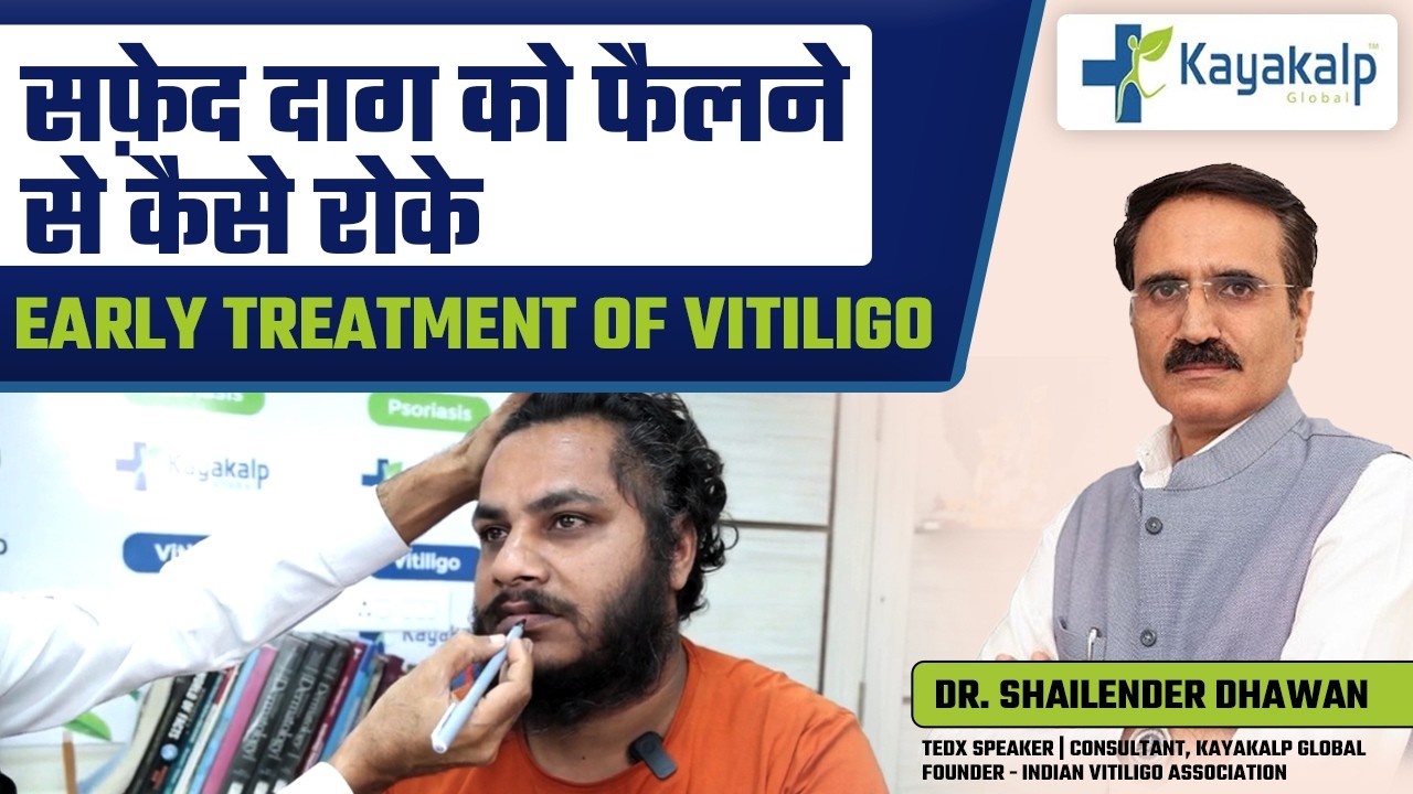 Finger Tips से Lips तक Vitiligo Spread? | Early Treatment से कैसे रोके | Real Patient Testimonial