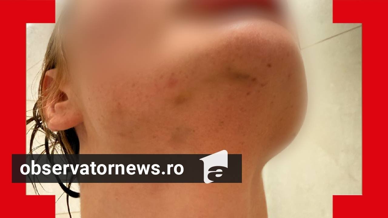 Poliţistul SAS care şi-a bătut crunt iubita înainte de nuntă dă vina pe tânără: 