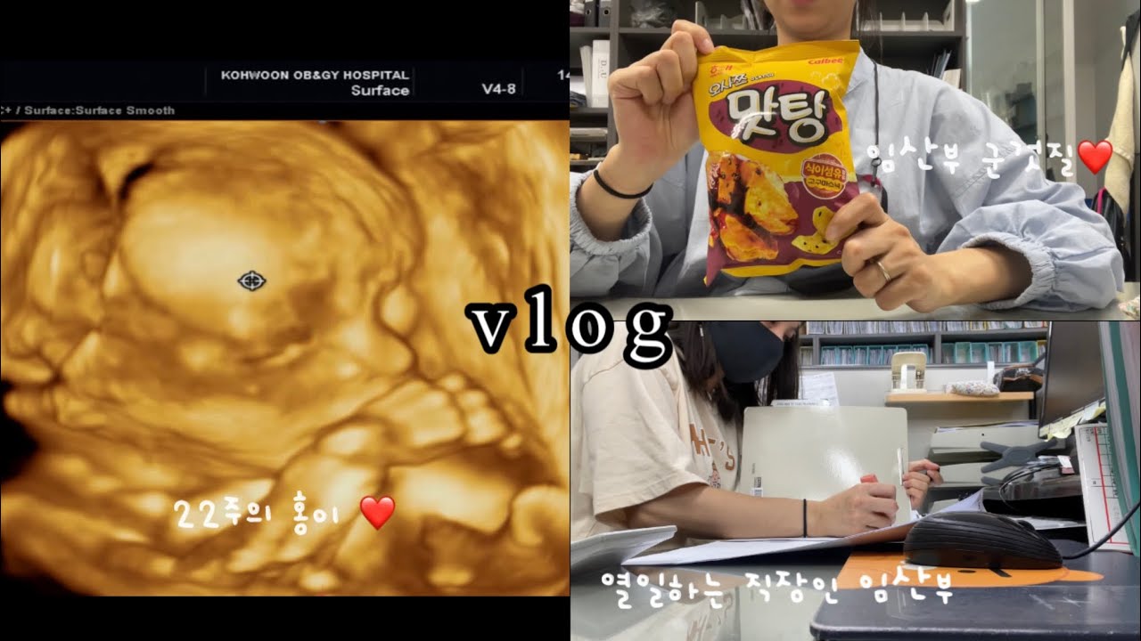 Vlog) 22주차 임산부 브이로그 / 직장인 브이로그 / 직장인임산부 / 22주차 주수기록 (정기검진, 몸무게기록,먹방, 붓기차, 튼살크림, 압박스타킹, 베이비페어)