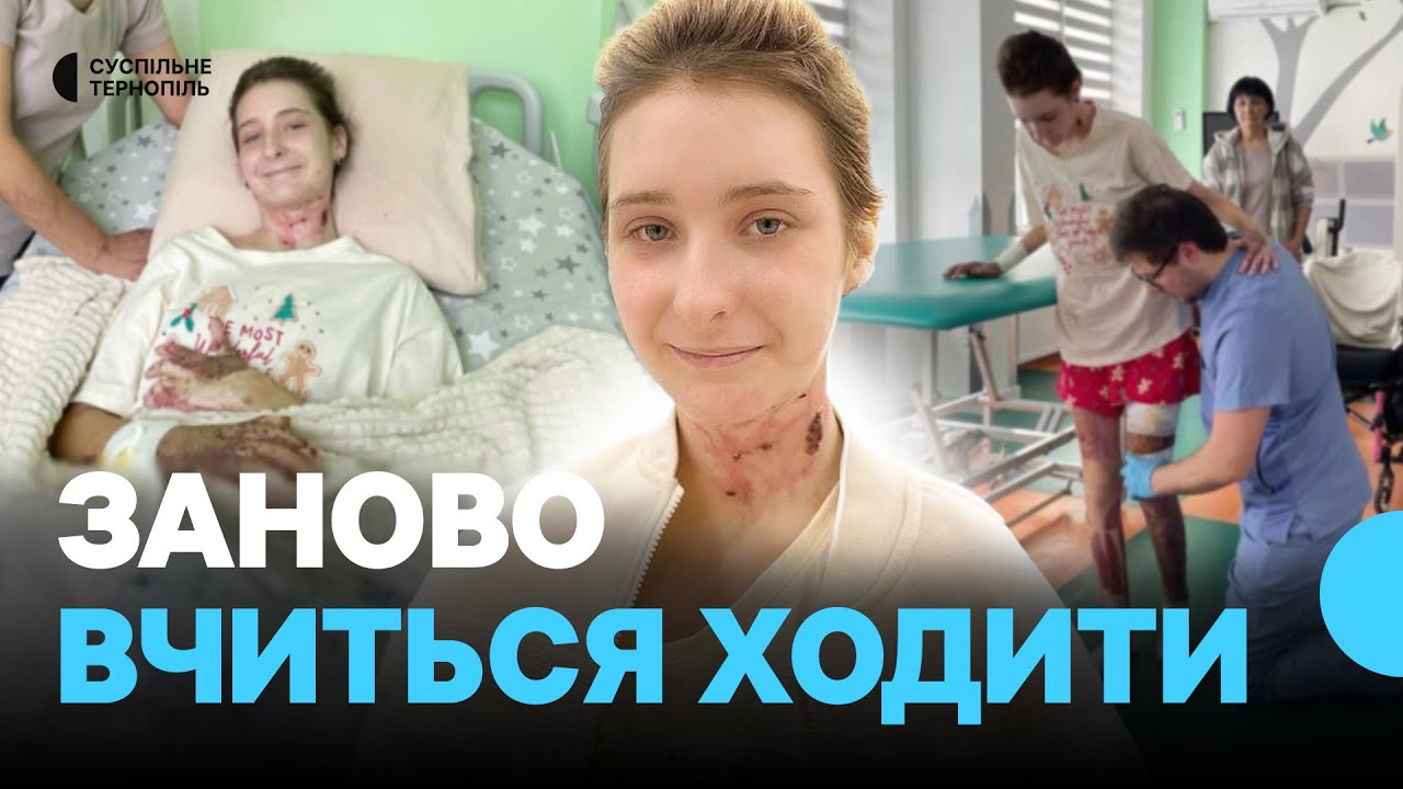 14-річна Анастасія Цяпало відновлюється після ракетного удару по Тернополю