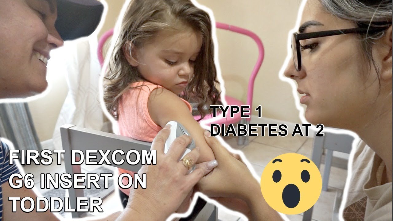 CGM FIRST TIME ON TODDLER