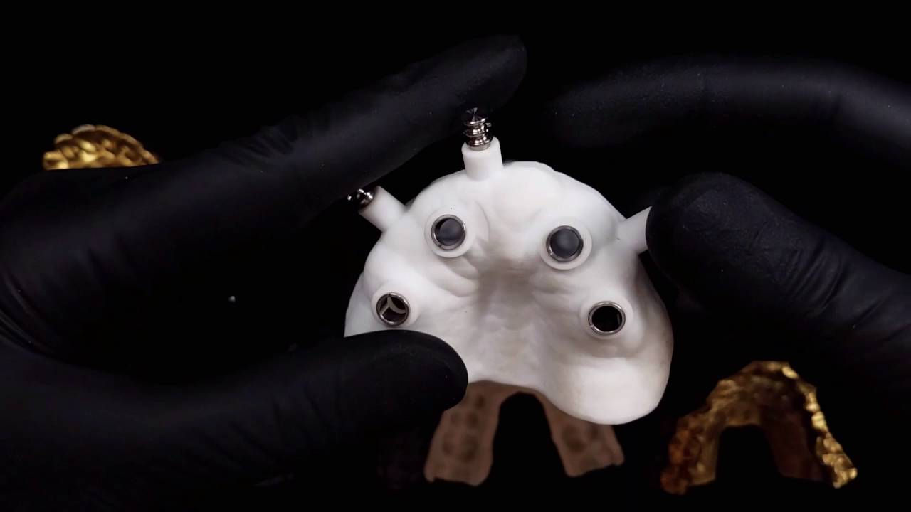 Digital Dentistry, 3D printing, and Juell 3D