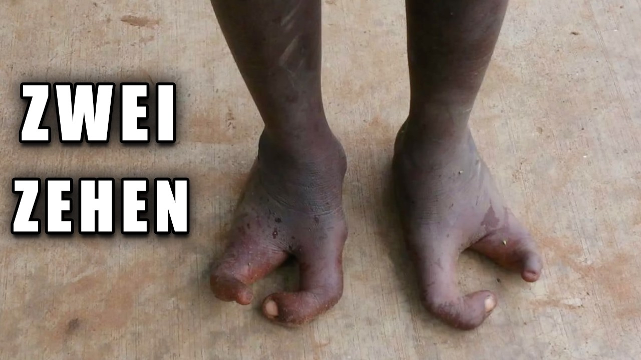 Das Volk mit den Strau&szlig;en-F&uuml;&szlig;en (Ich habe sie gefunden)