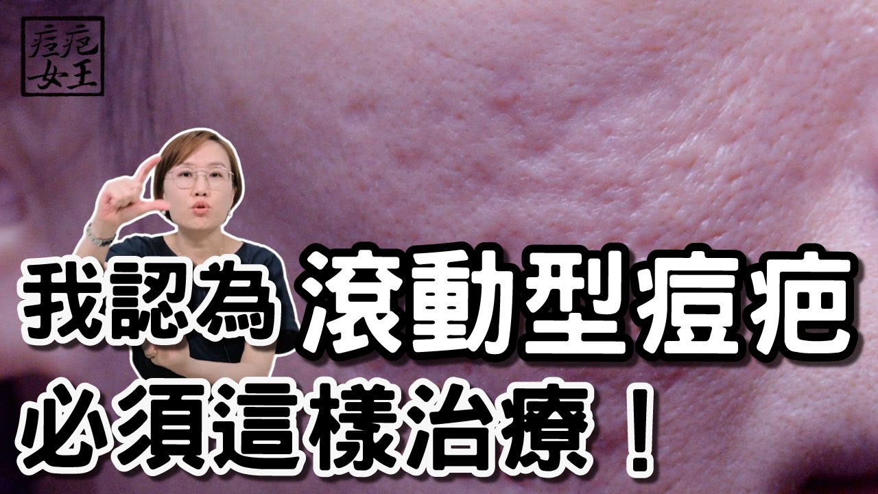 滾動型痘疤如何治療效果更好？痘疤的專業治療大公開！