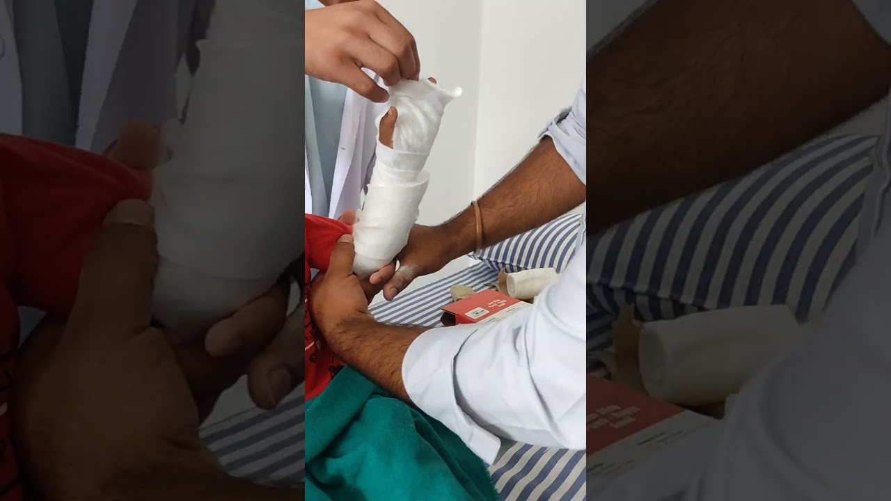 Pop plaster#hospitallife#bamslife#ayurvedalifestyle#ayur#ayurveda#surgeryday#like#support#ayurveda4