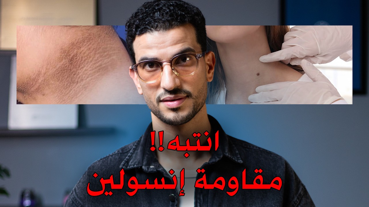 كيف تتخلص من مقاومة الانسولين قبل فوات الاوان ؟! قبل ان تصبح مريض سكر | د احمد الخطيب