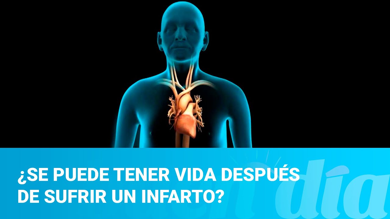 ¿Se puede tener vida después de sufrir un infarto?