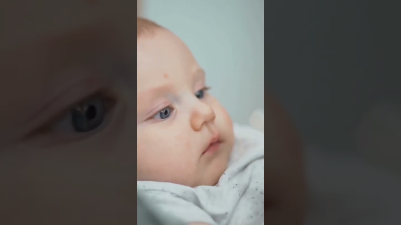 Tongue tie can affect both breastfeeding and bottle-feeding.