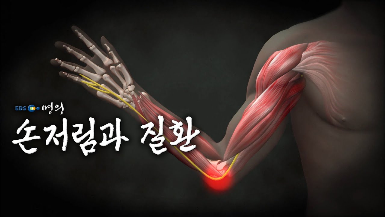 [명의 의학백과📖] 손저림과 질환
