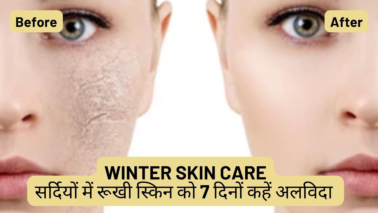 DRY SKIN CARE I रूखी और बेजान स्किन से मिलेगा छुटकारा अपनायें ये  टिप्स I Dr. Manoj Das