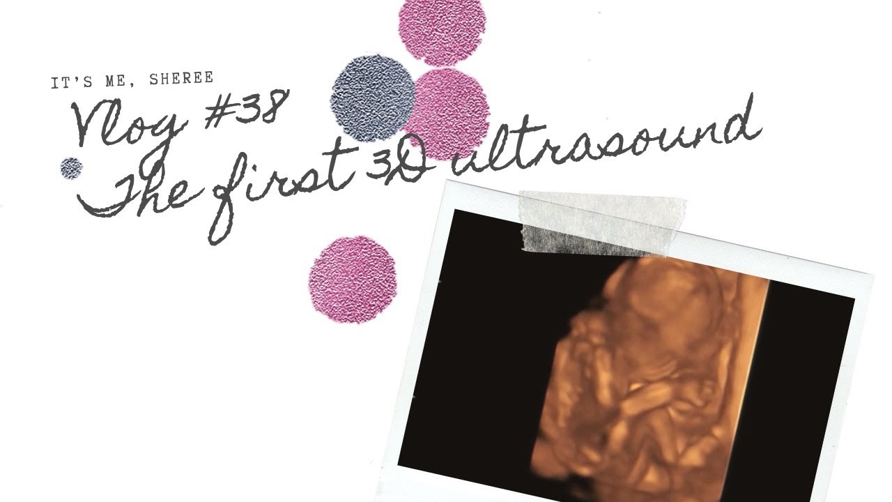 Pregnancy in Japan | What it’s like to get a 3D Ultrasound