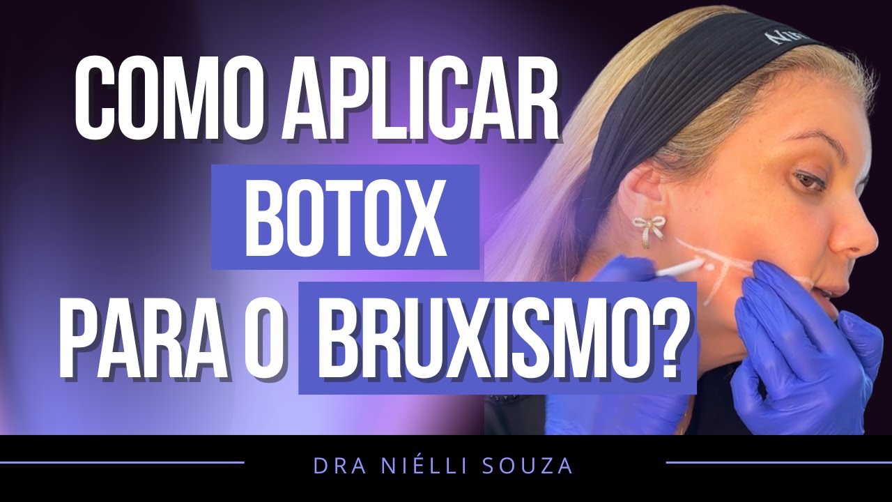 Como aplicar toxina botulínica para bruxismo ?