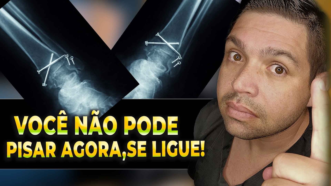 APÓS A CIRURGIA DE TORNOZELO ISSO DEVERÁ SER FEITO