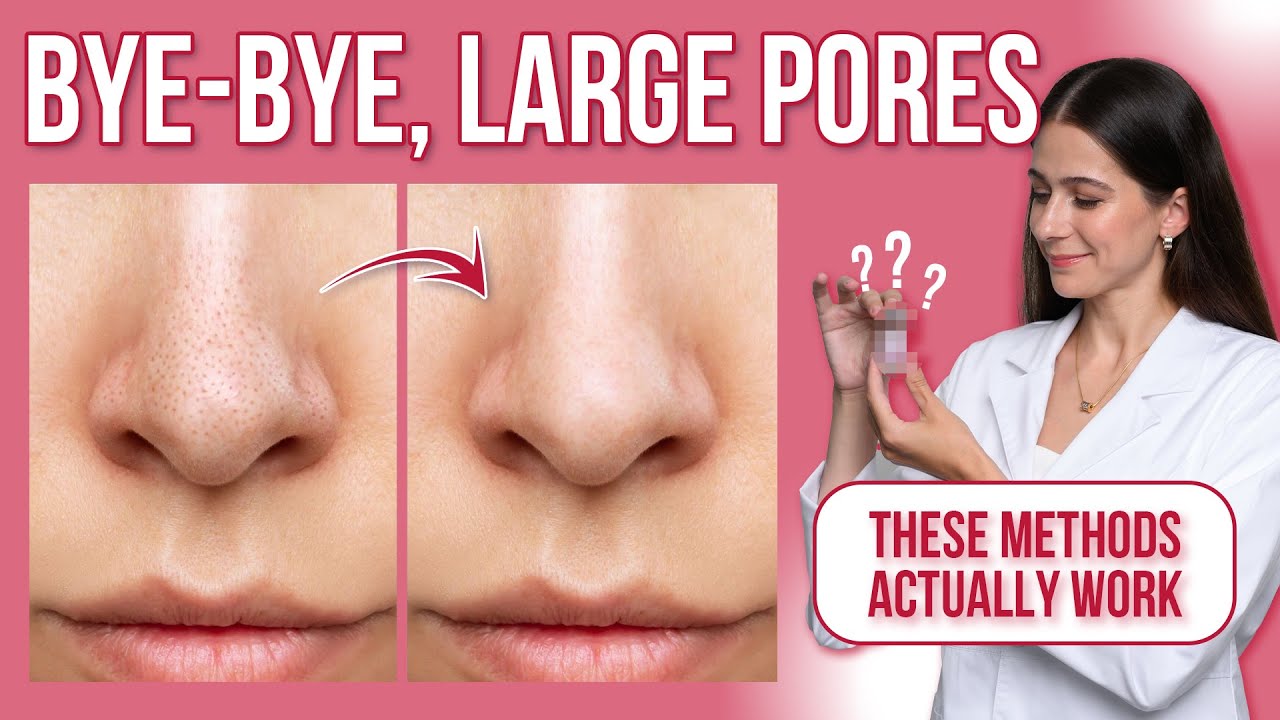 How to treat your open pores on face | Causes & Treatment | Guide for Clear Skin