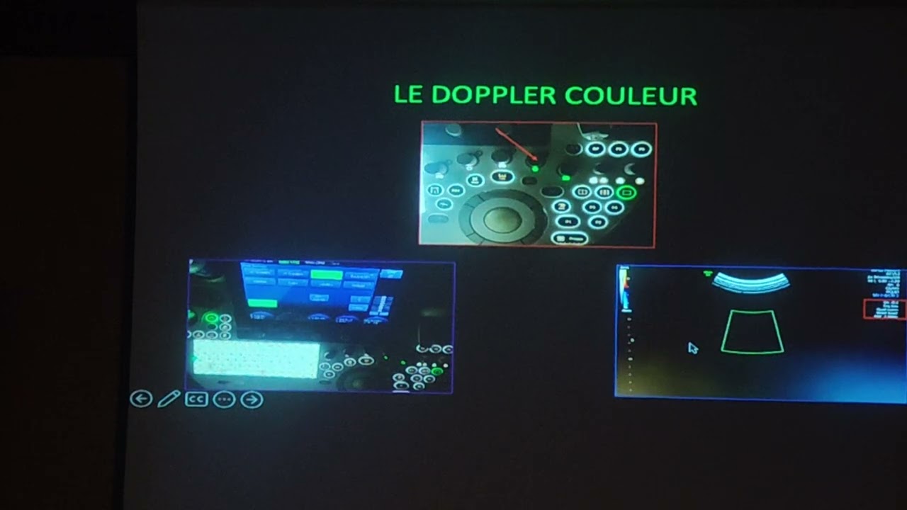 Journée Doppler dr kabar