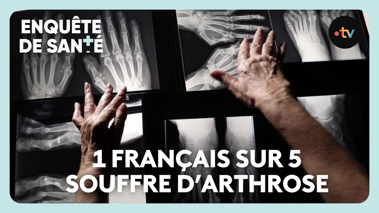 Rhumatismes : toutes les articulations en souffrance
