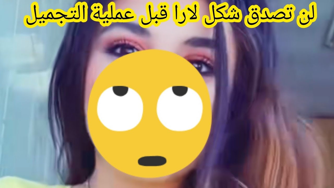 لن تصدق شكل لارا قبل عملية التجميل راحت لارا وظل أحمد برنامج قسمة ونصيب