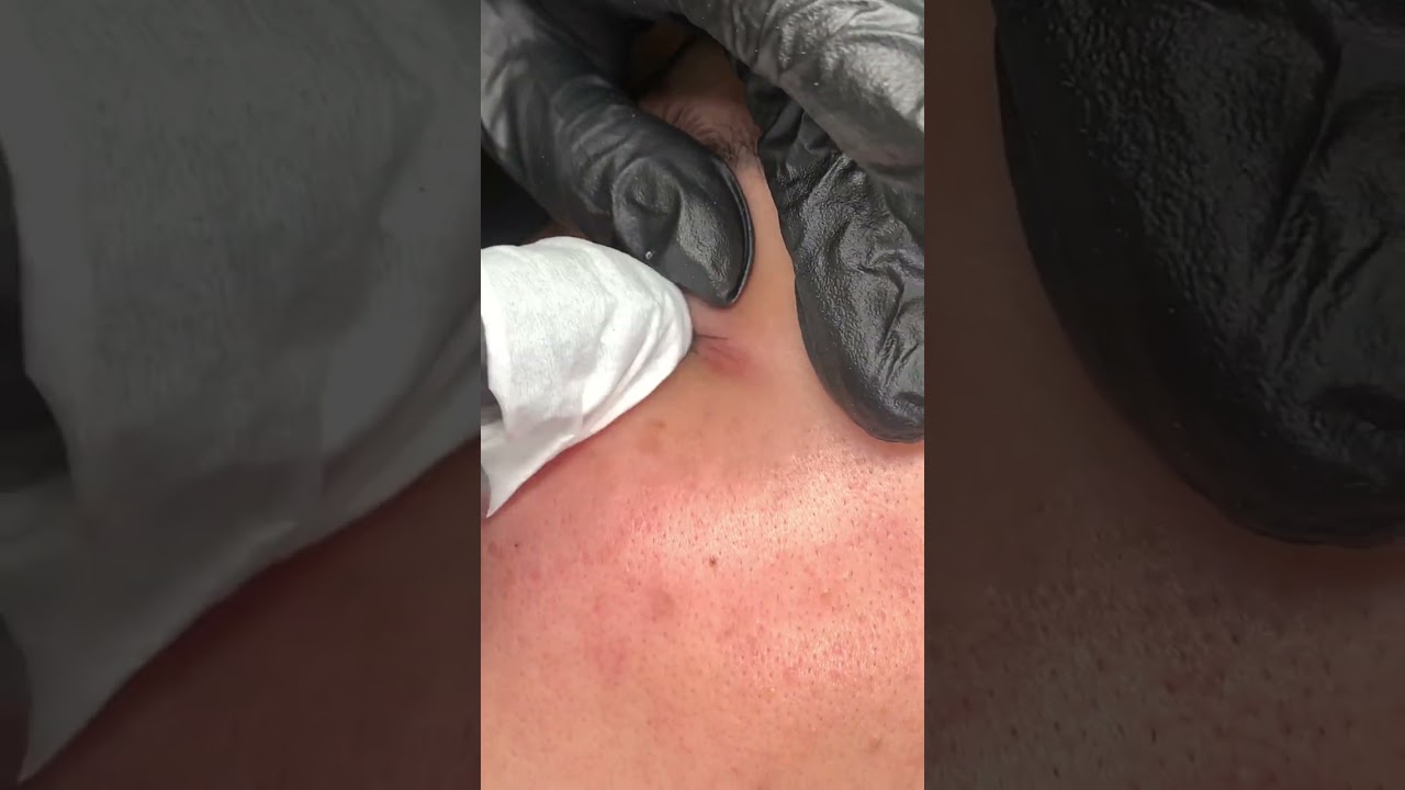 Chia sẻ cách phun mí mắt