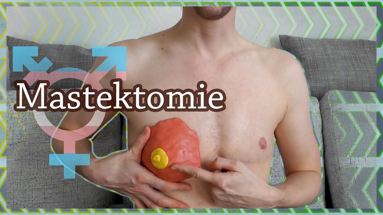 ¹⁰·⁰⁴·²⁰²⁰ Wie funktioniert die Mastektomie?