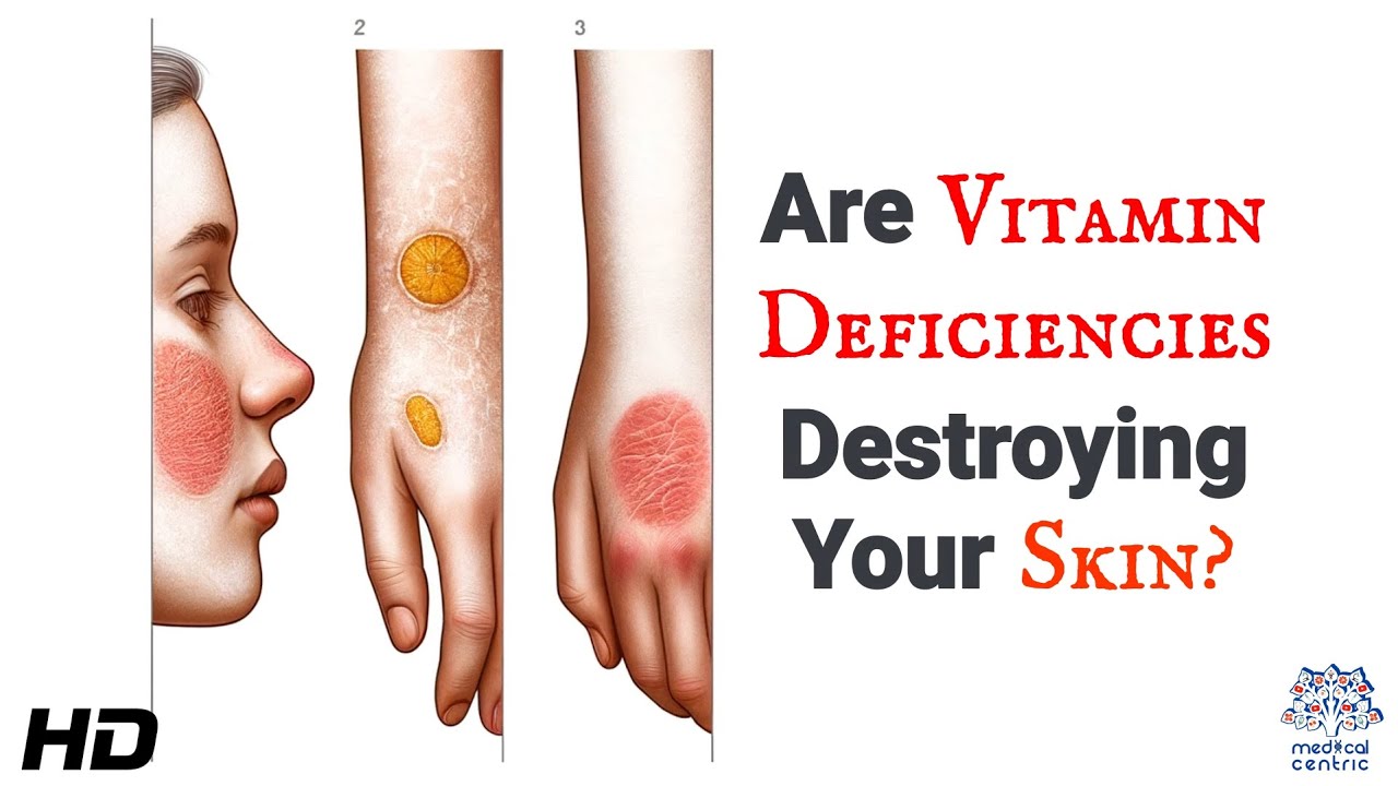 Are Vitamin Deficiencies Destroying Your Skin ? The Hidden Nutrient Crisis